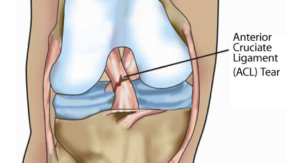 anatomy_of_knee