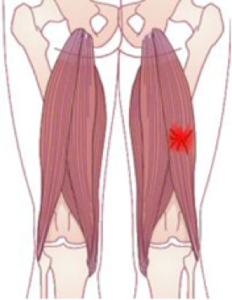 hamstrings